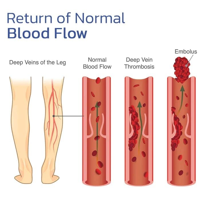 RamanoFlex™ — Melt Away Knee Pain for Freedom to Move with Comfort and Confidence