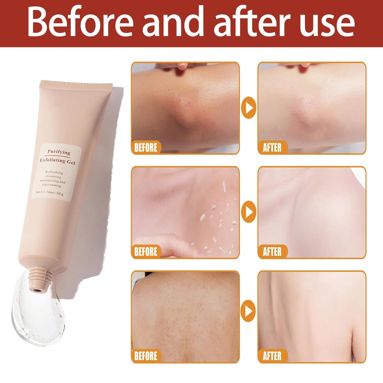 GlowCraft™ Exfoliating Gel — Reveal Radiant, Baby-Soft Skin That Commands Attention Instantly