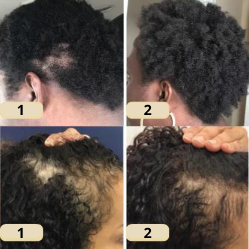 ElevaVive™ — Unlock Rich, Full-Bodied Hair That Commands Attention