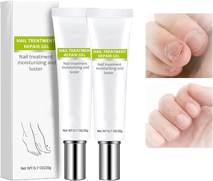 VeraNex™ Repair Gel — Transform Fragile Nails Into Stunning Strength You Can Flaunt