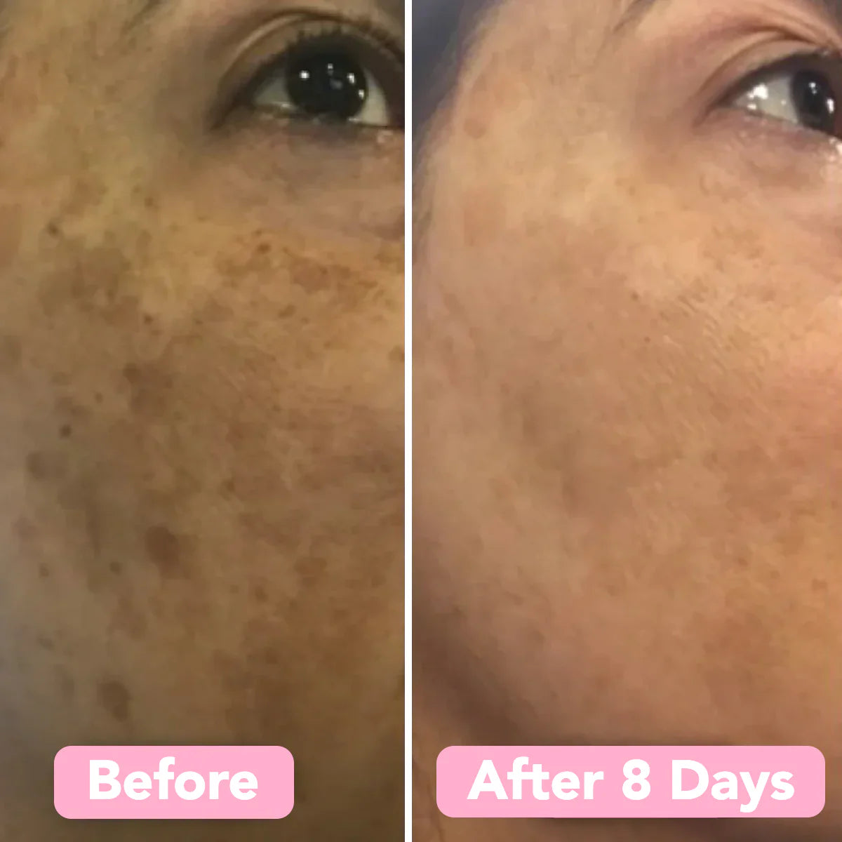 LumiFleur™ Radiance Pads — Wake Up to Instantly Brighter, Smoother, Spotless Skin