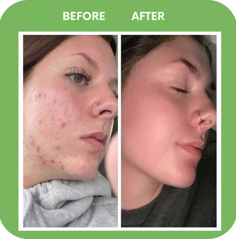 VerdantiFlourish™ — Unleash Radiant, Clear Skin That Commands Every Mirror and Moment