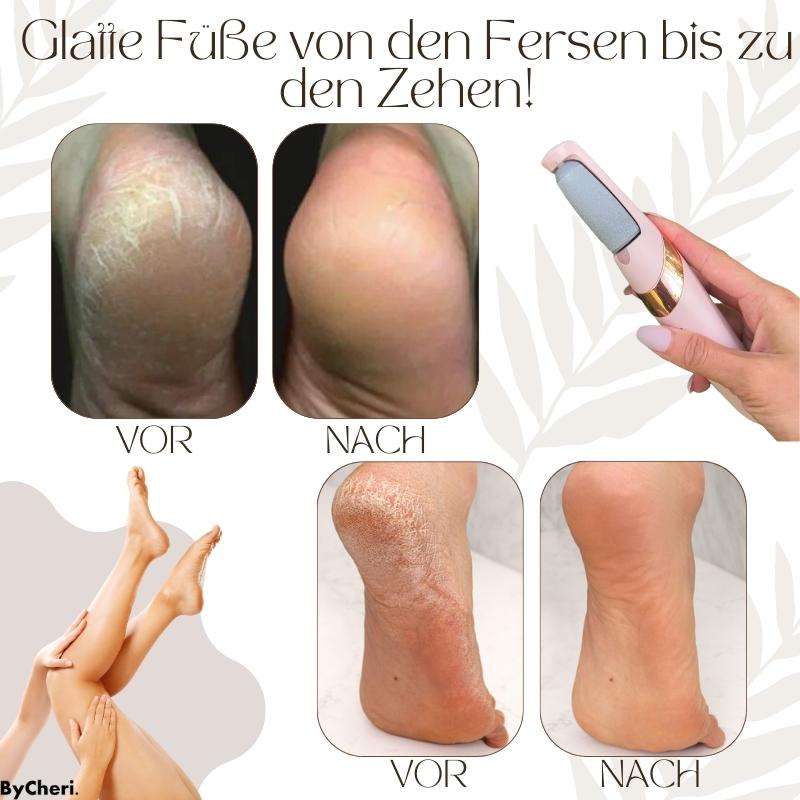 VelvetStep™ — Effortless Salon-Soft Feet That Boost Your Confidence Instantly