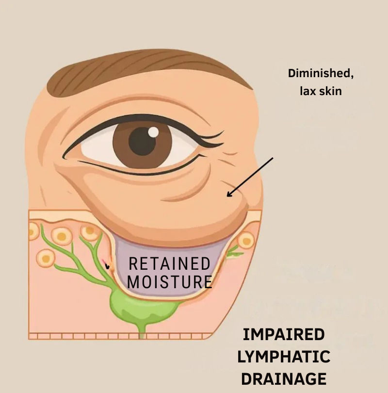 LumaLift™ — Wake Up to Youthful, Puff-Free Eyes That Spark Confidence