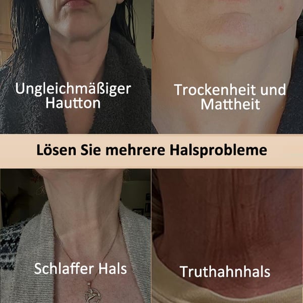 LumoraLift™ — Instantly Firm & Hydrate for Neck and Décolleté Confidence