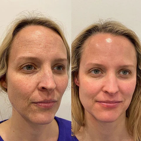LumaPulse™ — Experience Pore-Clarity and Glow That Turns Heads Instantly