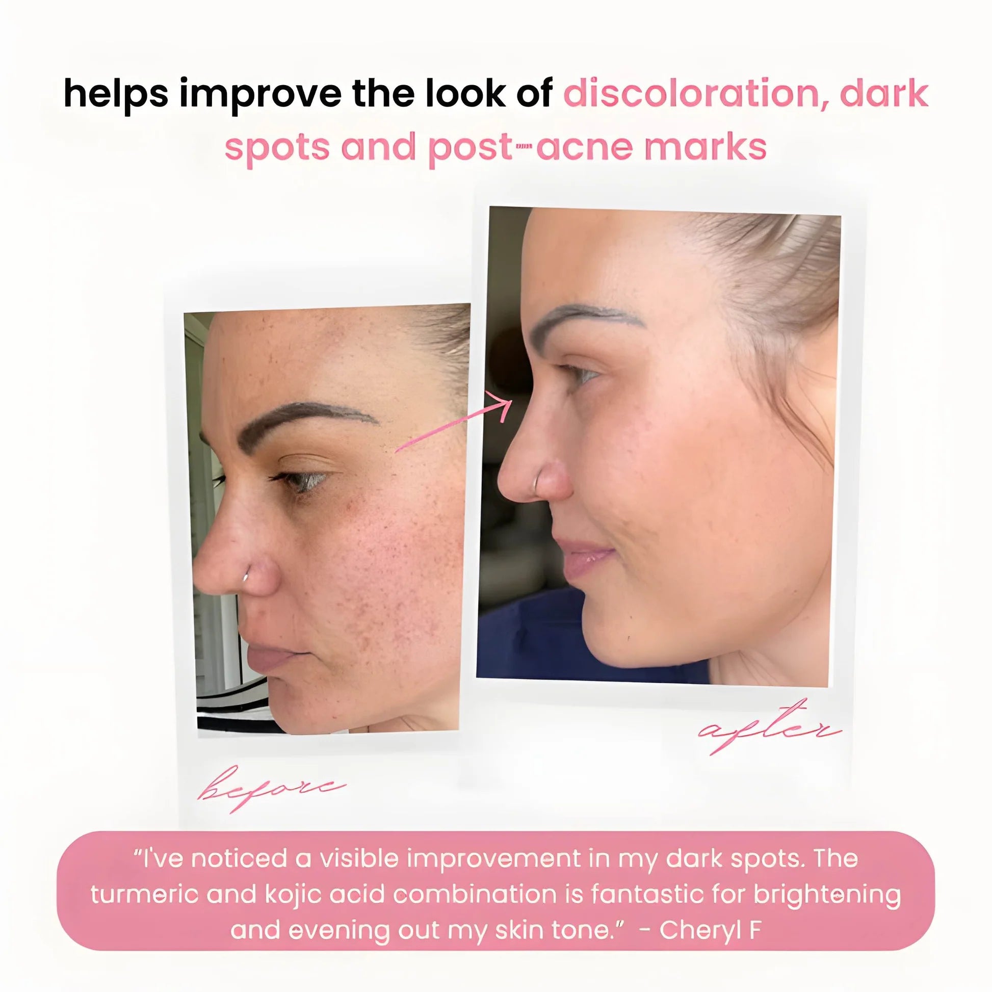LumiFleur™ Radiance Pads — Wake Up to Instantly Brighter, Smoother, Spotless Skin