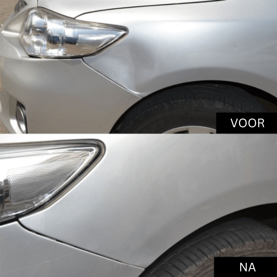 DentAway™ — Effortless Dent Repair That Makes Your Ride Shine Like New