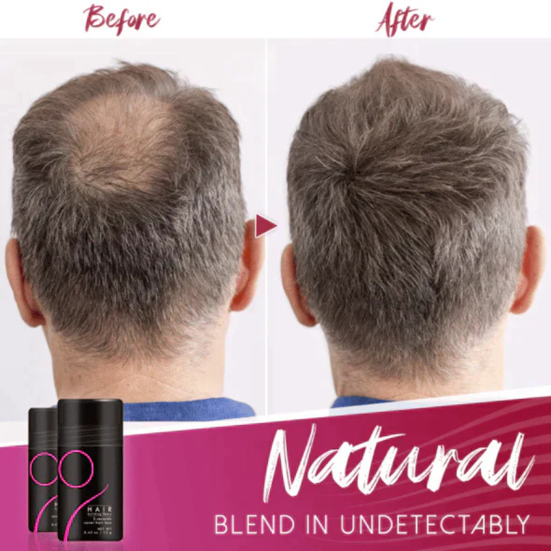 VolaDermis™ — Instantly Transform Thinning Hair Into Full, Luscious Volume That Commands Attention