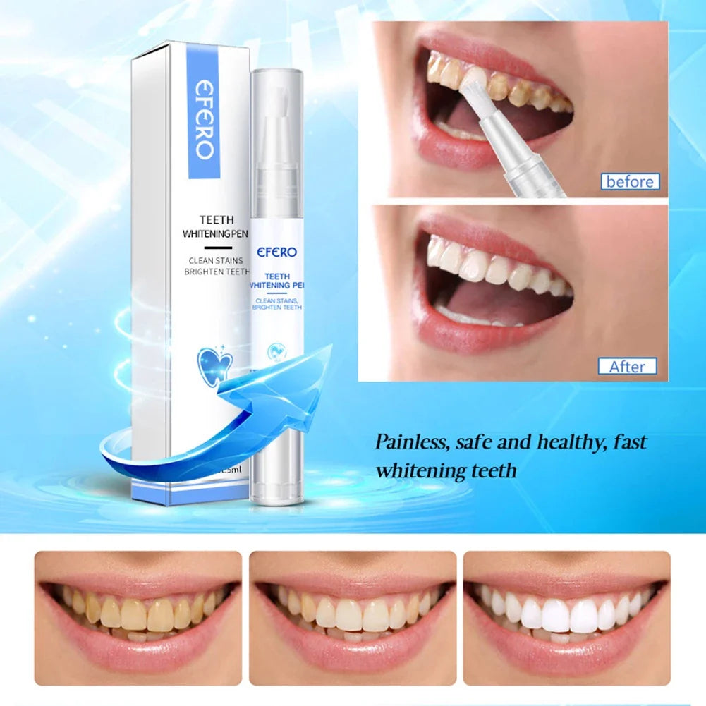 LumaBeam™ — Unlock a Radiant Smile That Boosts Your Confidence Instantly