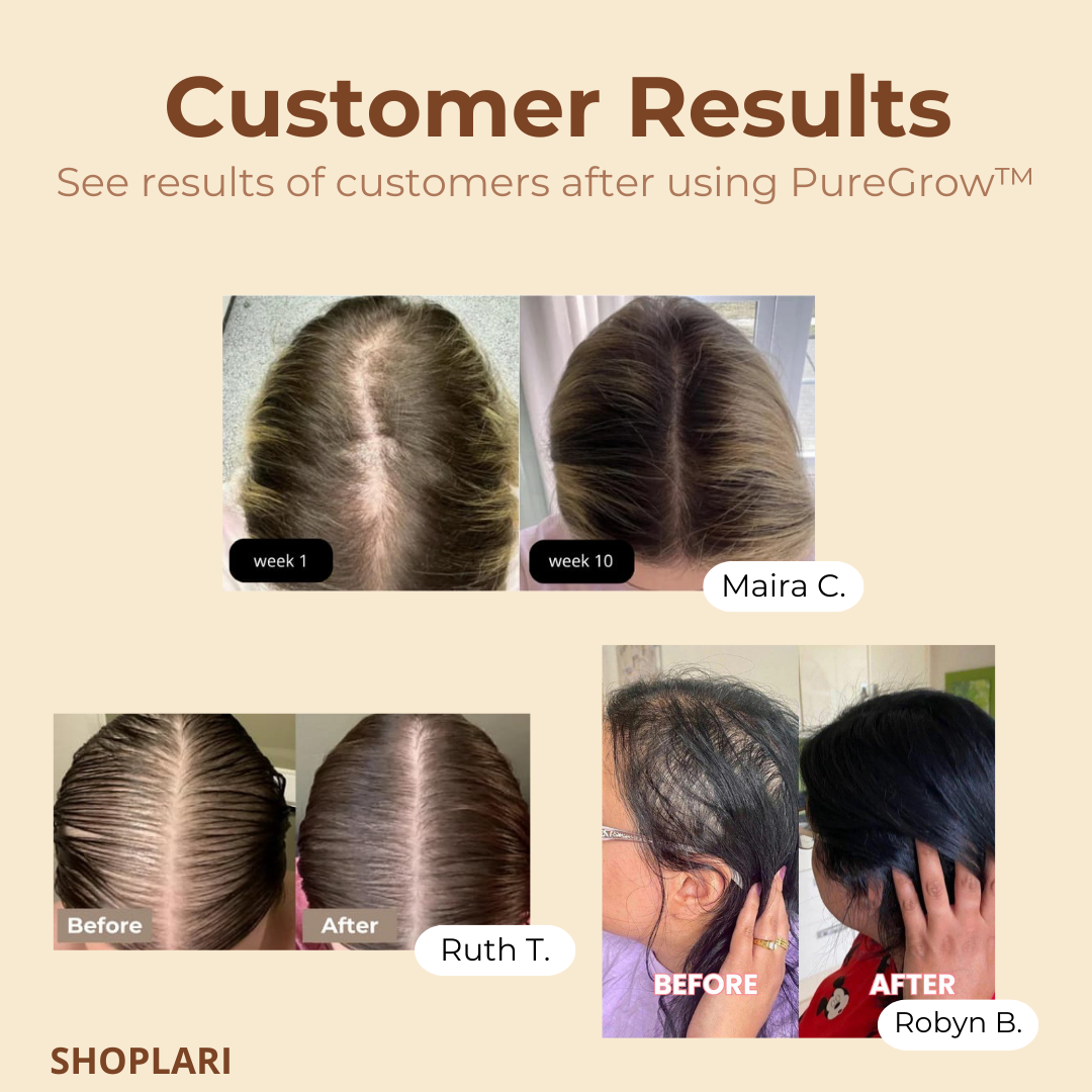 DewLuxe™ — Ignite Strength and Bring Your Hair Back to Life