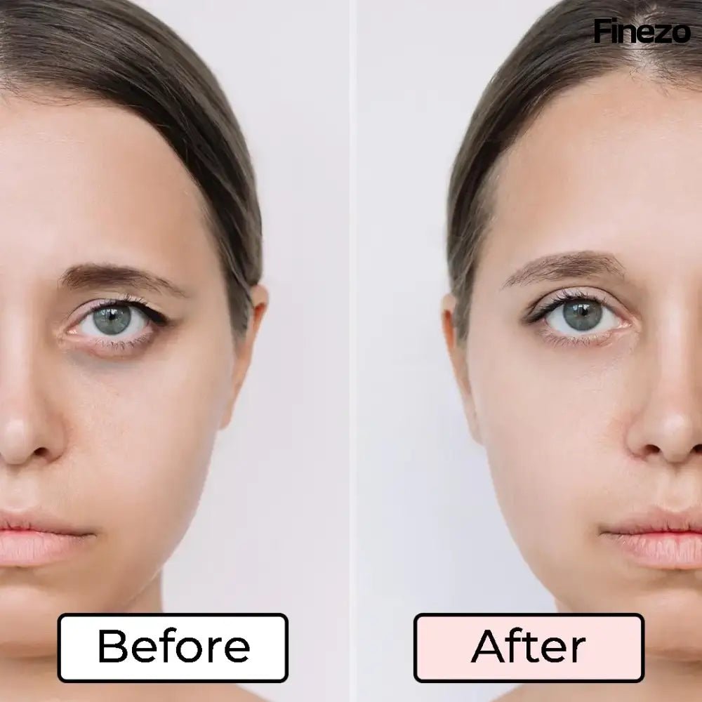 RadiAura™ — Instantly Revive Tired Eyes for a Radiant, Youthful Glow