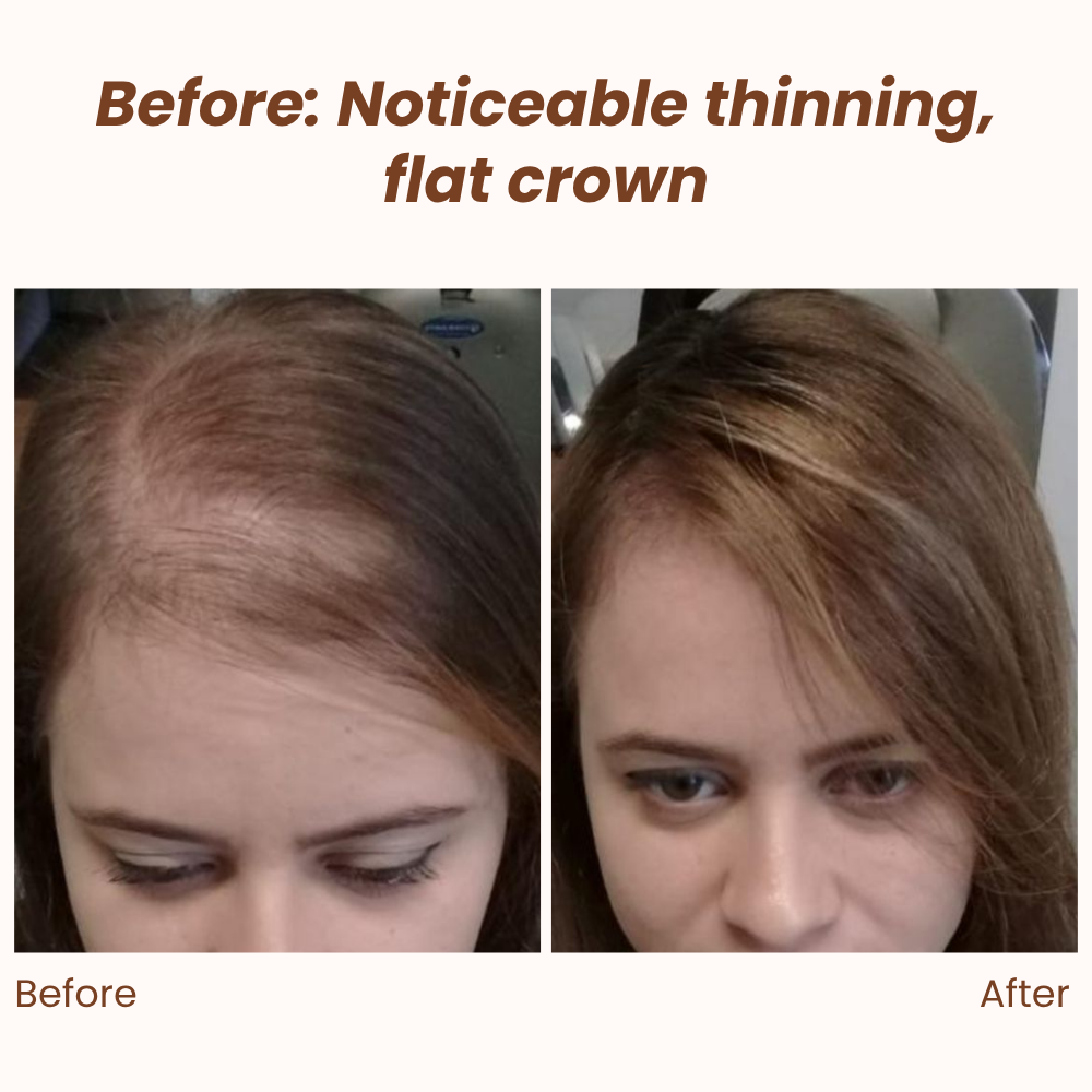 RamiraVeil™ — Instantly Restore Your Confidence with Undetectable Volume and Flawless Coverage