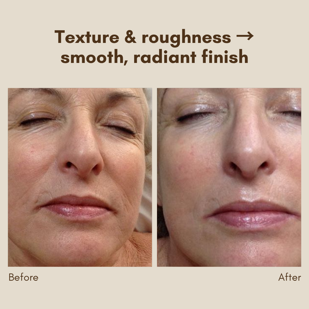 LumiSphere™ — Unleash Radiant, Silky-Smooth Skin That Demands Attention