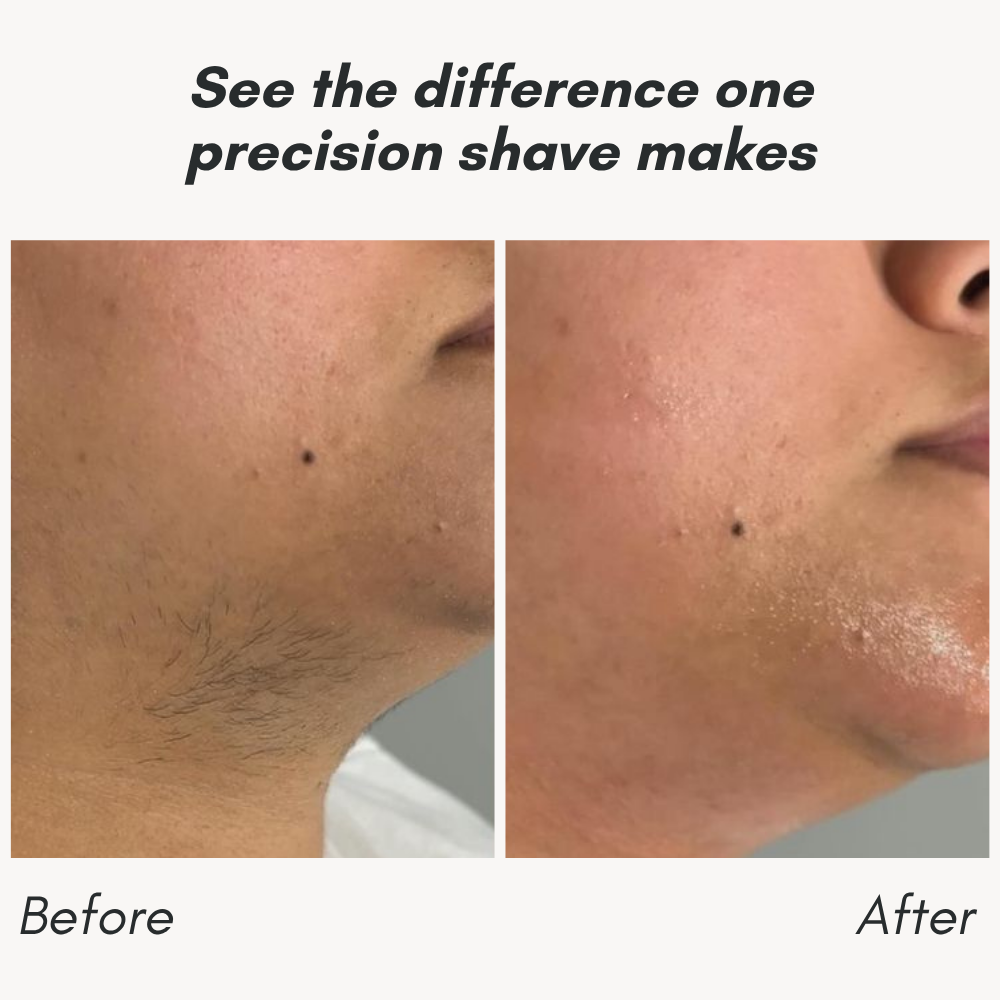 RamoxoPro™ — Effortless Precision Shaving That Leaves Your Skin Silky-Smooth and Irritation-Free