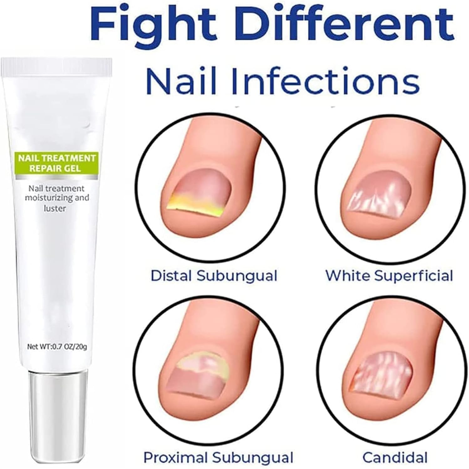 VeraNex™ Repair Gel — Transform Fragile Nails Into Stunning Strength You Can Flaunt