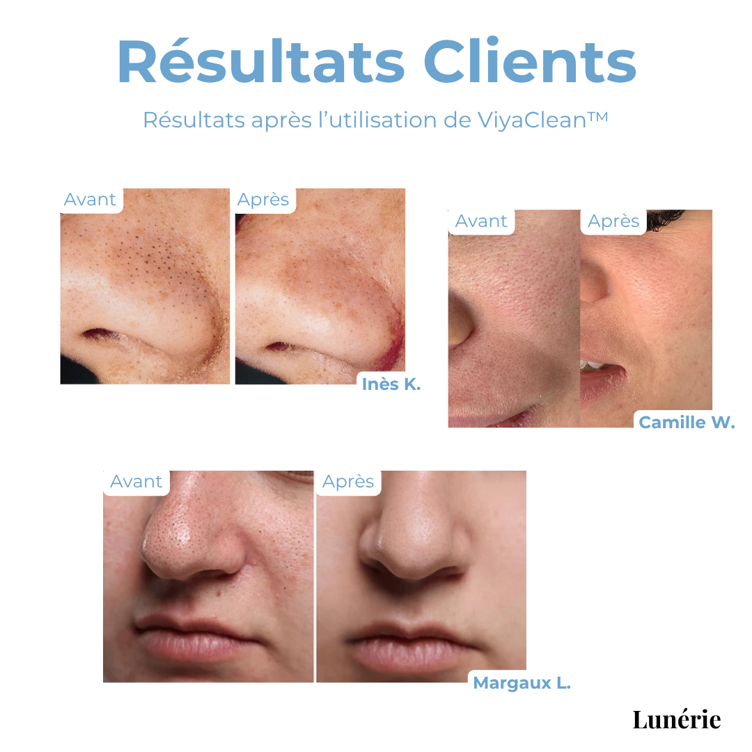 PurePore™ — Clear Away Blackheads for Radiant, Smooth Skin That Turns Heads