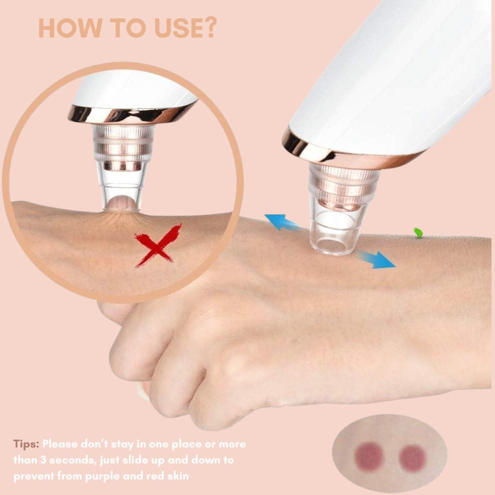 50% Discount Temporary | Derma Treatment Device