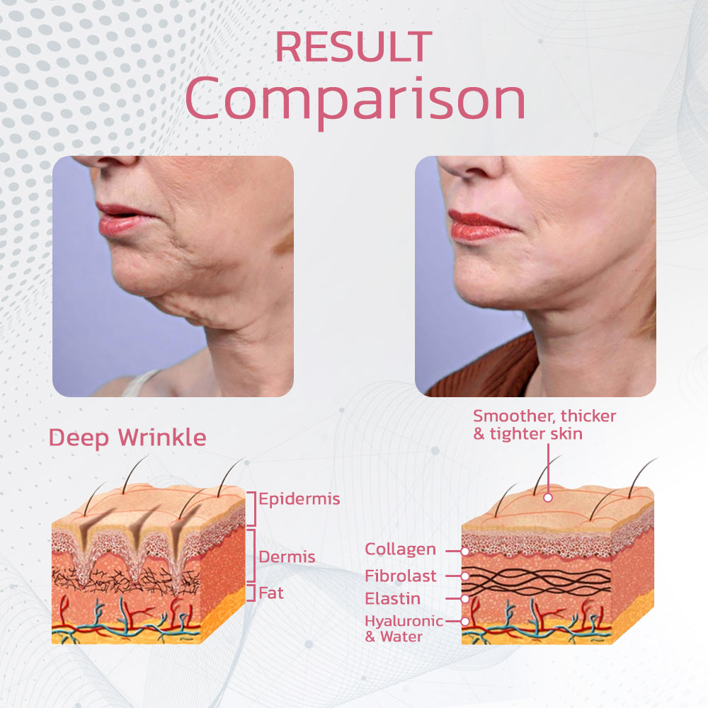 Temporary 50% Discount | Cleanse Your Lymphatic System!