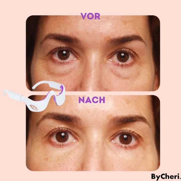 50% OFF TEMPORARY | Eye Massage Device for Relaxation Anywhere