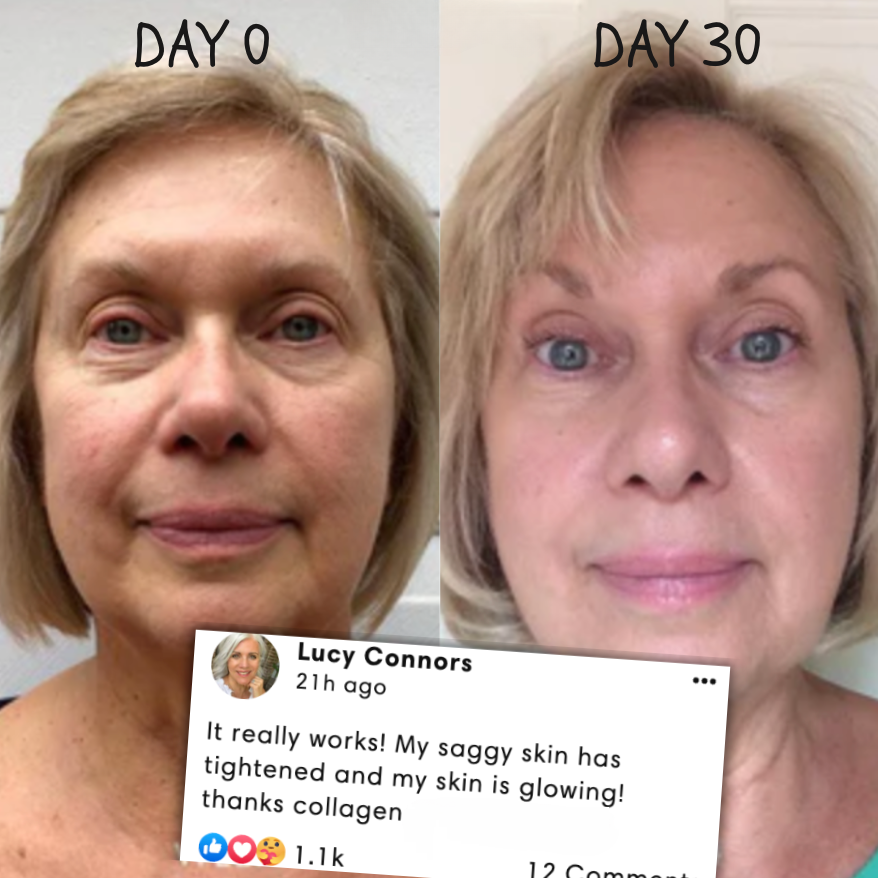 50% OFF TEMPORARY | RevitaMask | Experience Firm and Radiant Skin!