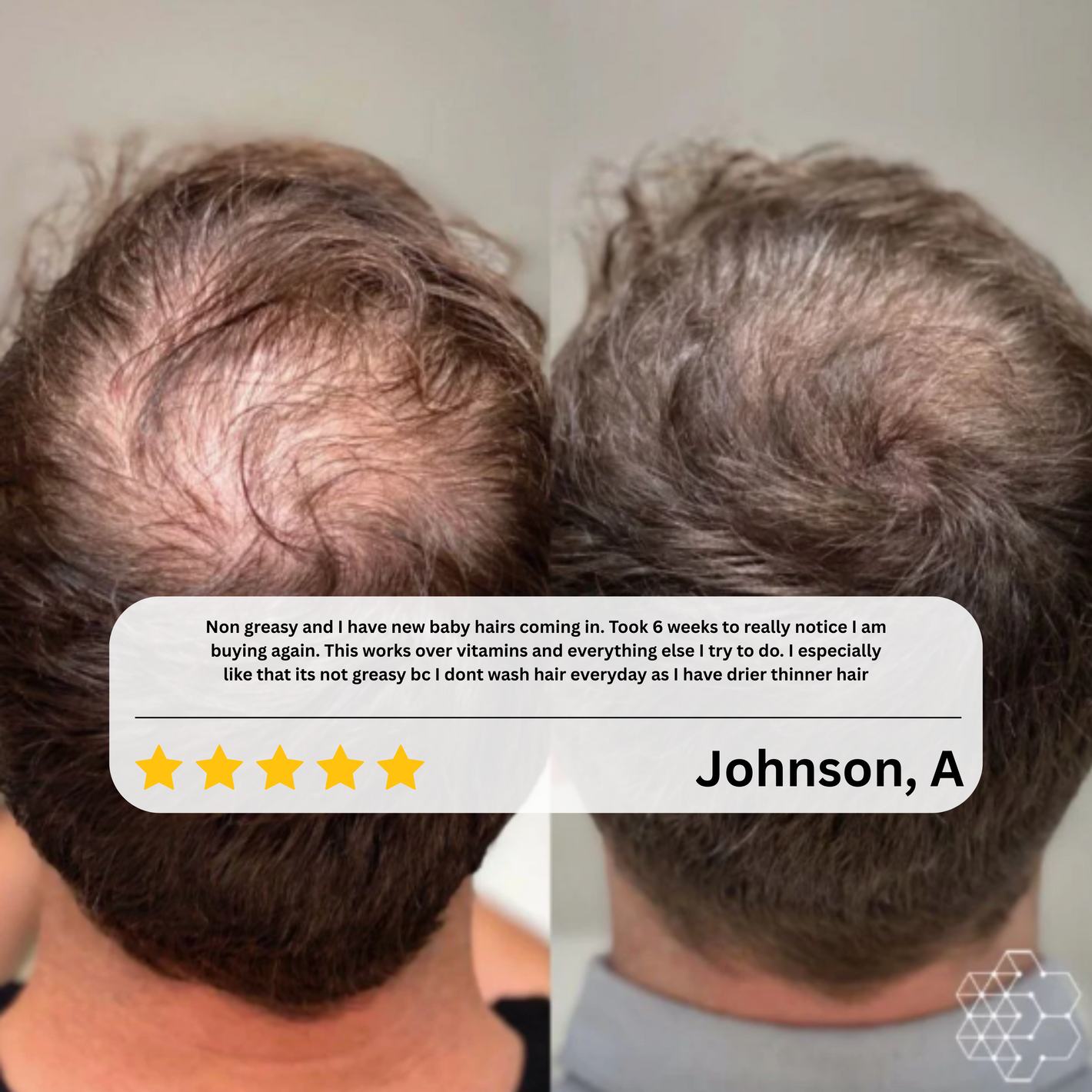 CrownMist™ — Unlock Fuller, Thicker Hair That Boosts Your Confidence Every Day