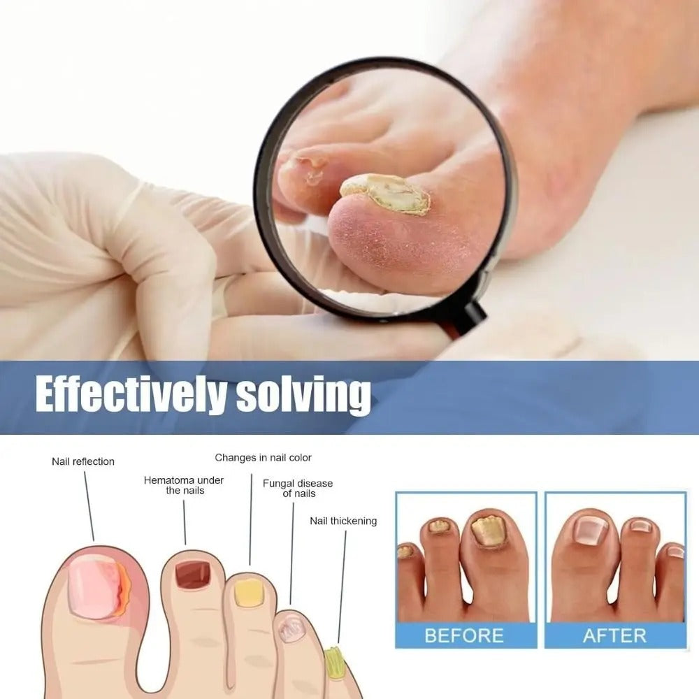 VitaNail Restore™ — Finally Reveal Clear, Strong Nails That Boost Your Confidence Every Day