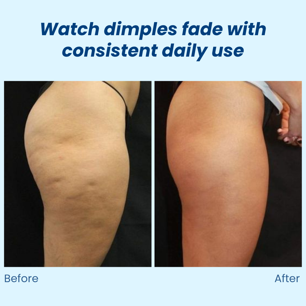 VividSculpt™ — Reveal Silky, Sculpted Skin That Boosts Your Confidence Every Day