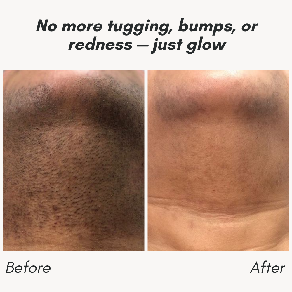 RamoxoPro™ — Effortless Precision Shaving That Leaves Your Skin Silky-Smooth and Irritation-Free