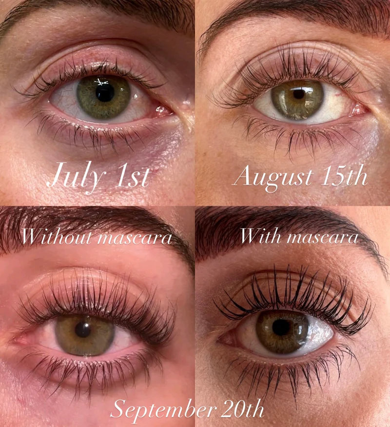 LashAura™ — Wake Up to Stunning, Full Lashes in Just 7 Days