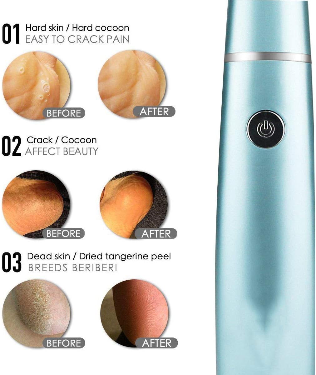 Achieve Silky Smooth Feet with Our Advanced Foot Care Device