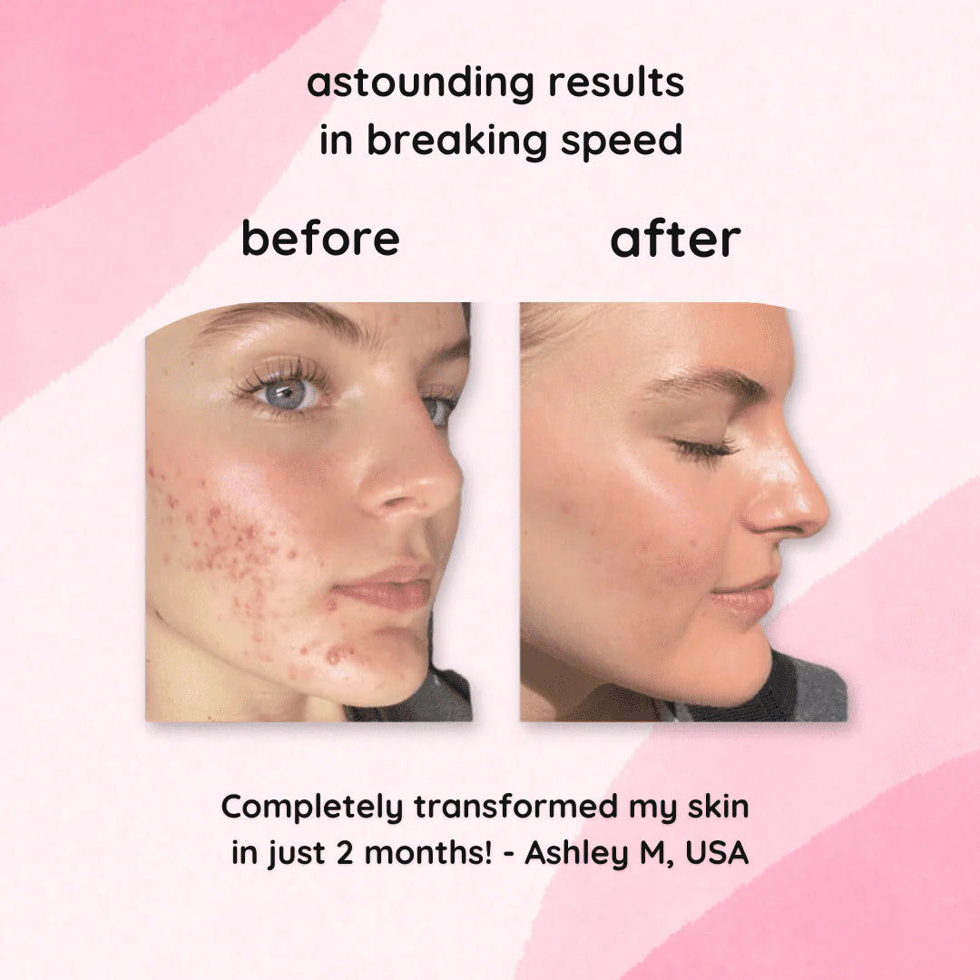 LumiFleur™ Radiance Pads — Wake Up to Instantly Brighter, Smoother, Spotless Skin