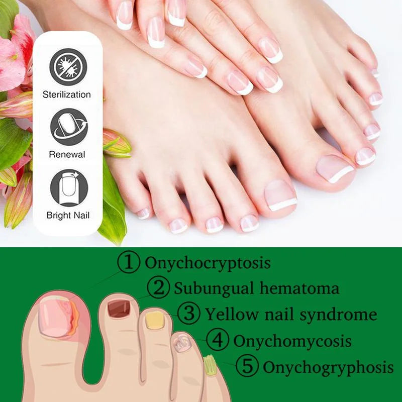 NailVita™ — Revive Your Nails with Nature’s Healing Power and Show Off Strong, Stunning Hands