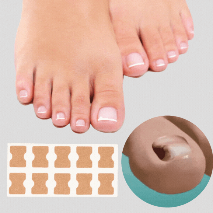 NailRevive™ — Walk Pain-Free and Proud with Perfectly Restored Nails