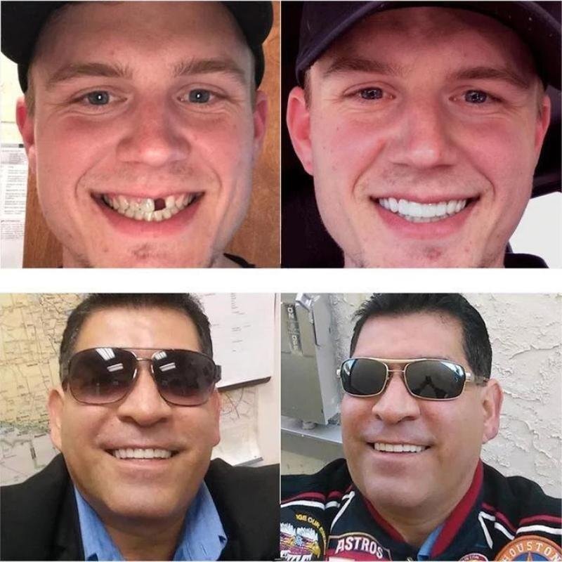 LumaPearl™ Smile Shield — Instantly Own a Flawless Smile That Feels 100% You