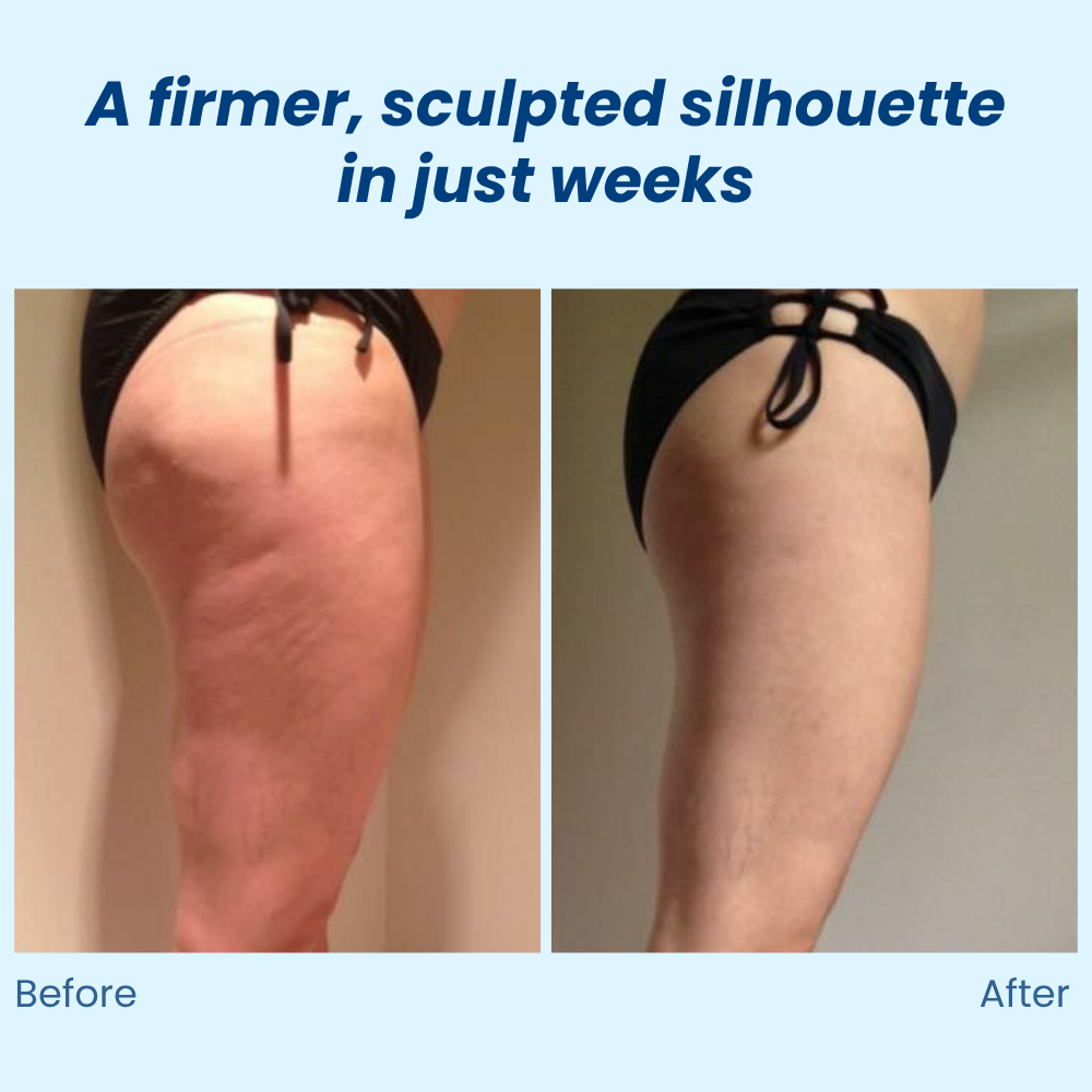 VividSculpt™ — Reveal Silky, Sculpted Skin That Boosts Your Confidence Every Day