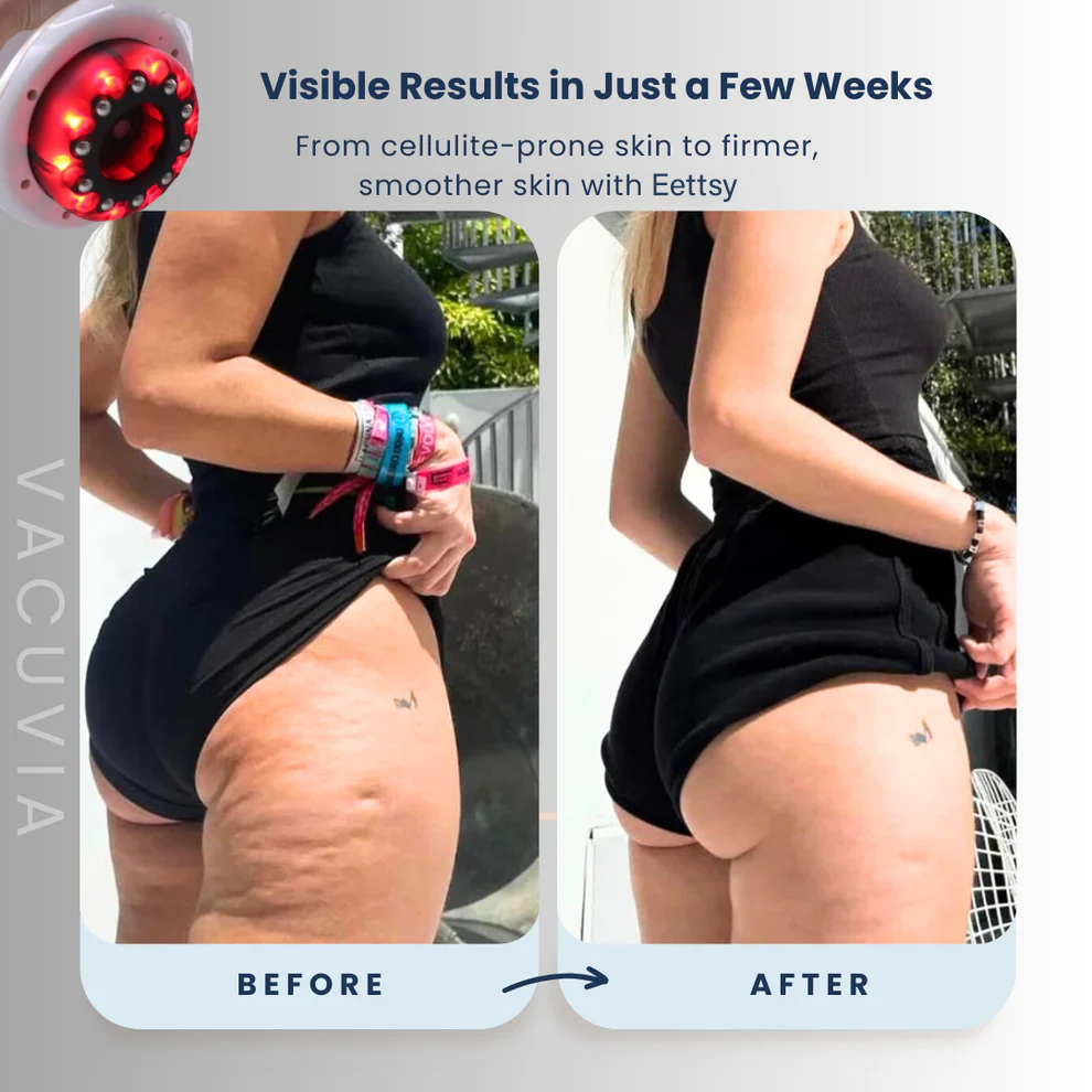 LumaSculpt™ — Transform Your Skin to Stunning Firmness and Silky Smooth Confidence
