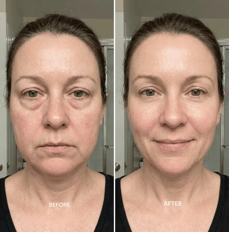 LumaVive™ — Awaken Radiant, Sculpted Skin That Turns Heads Instantly