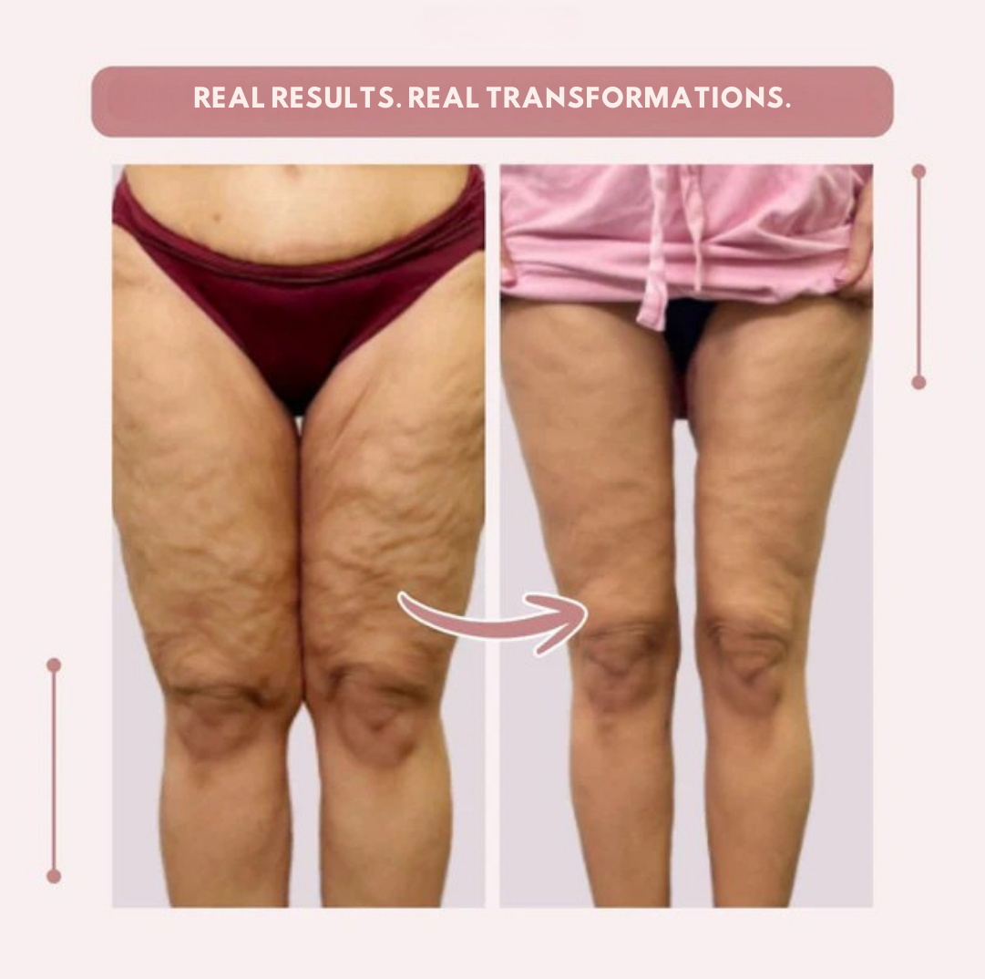 Vibrissea™ — Feel Flawless and Fierce in Every Curve
