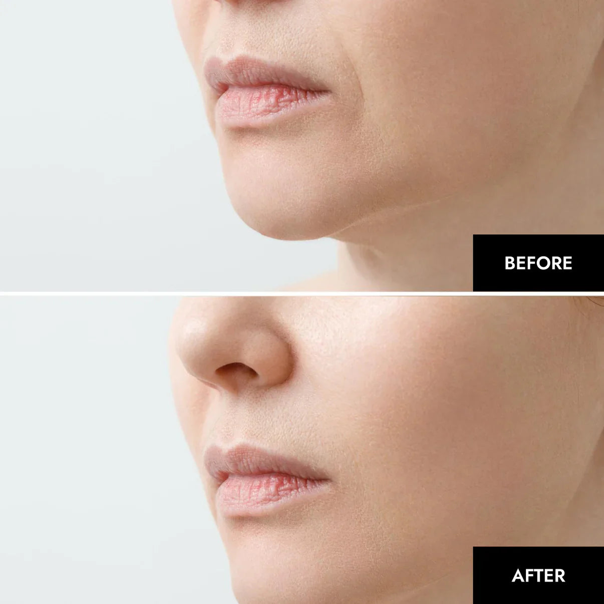 DermaSculpt™ Collagen Infusion — Reveal Firmer, Radiant Skin That Defies Time