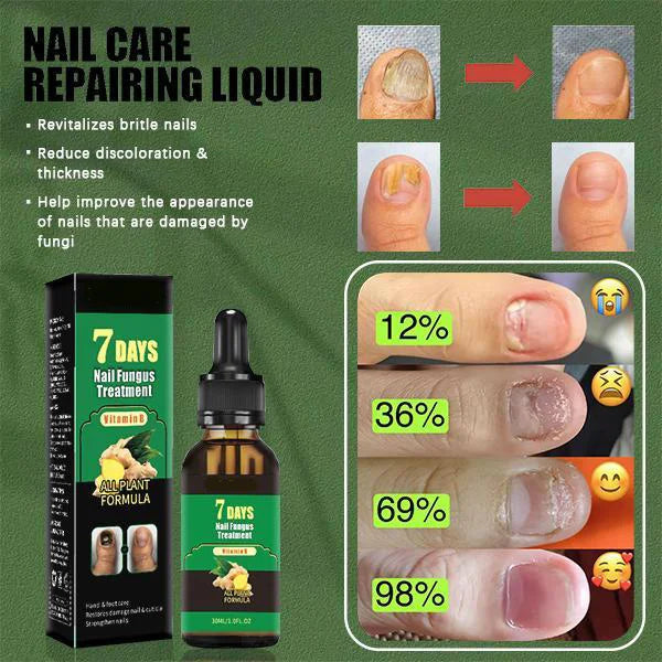 NailVita™ — Revive Your Nails with Nature’s Healing Power and Show Off Strong, Stunning Hands
