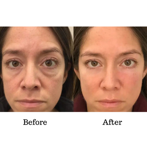 EyeVerra™ — Smooth Away Wrinkles Instantly for Youthful, Radiant Eyes