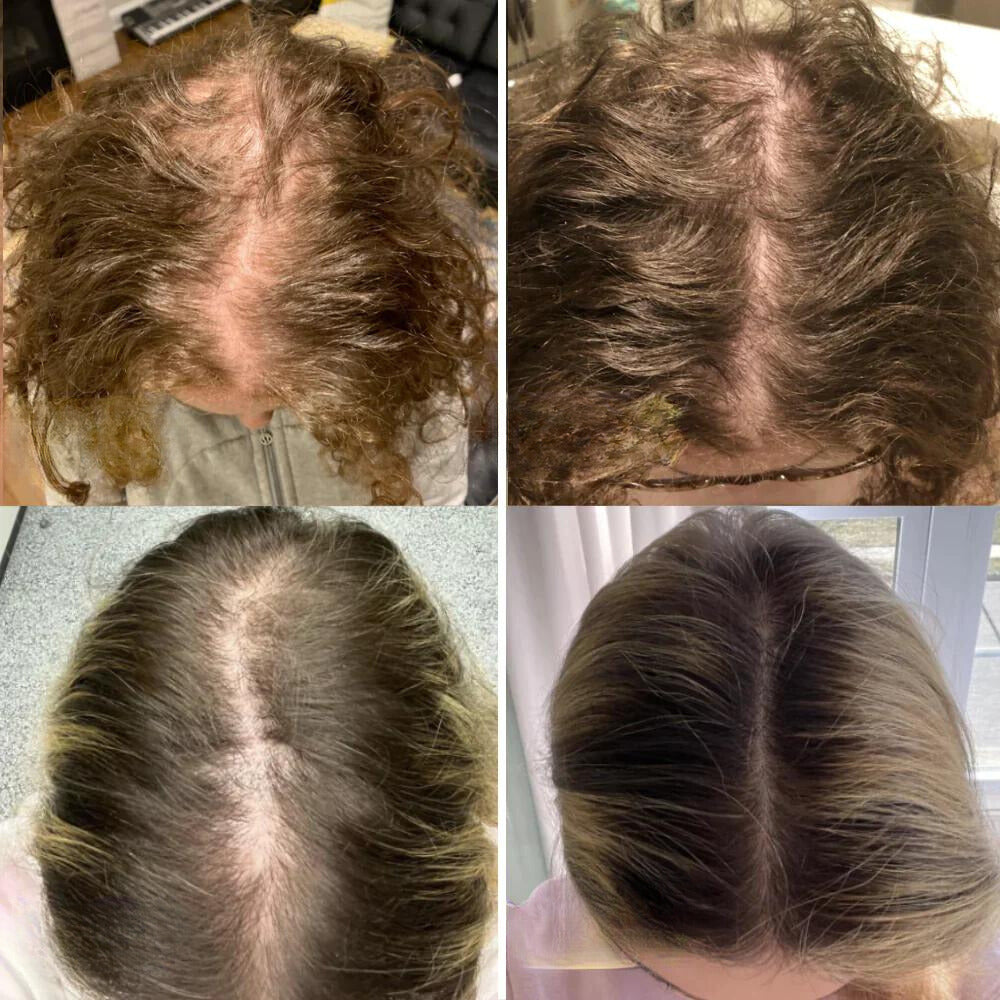 RevitaCrown™ — Ignite Your Scalp’s Power for Thick, Head-Turning Hair