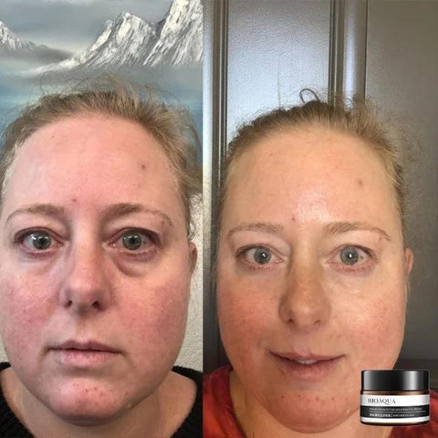 RamoraLift™ — Reveal Radiant, Youthful Eyes Instantly