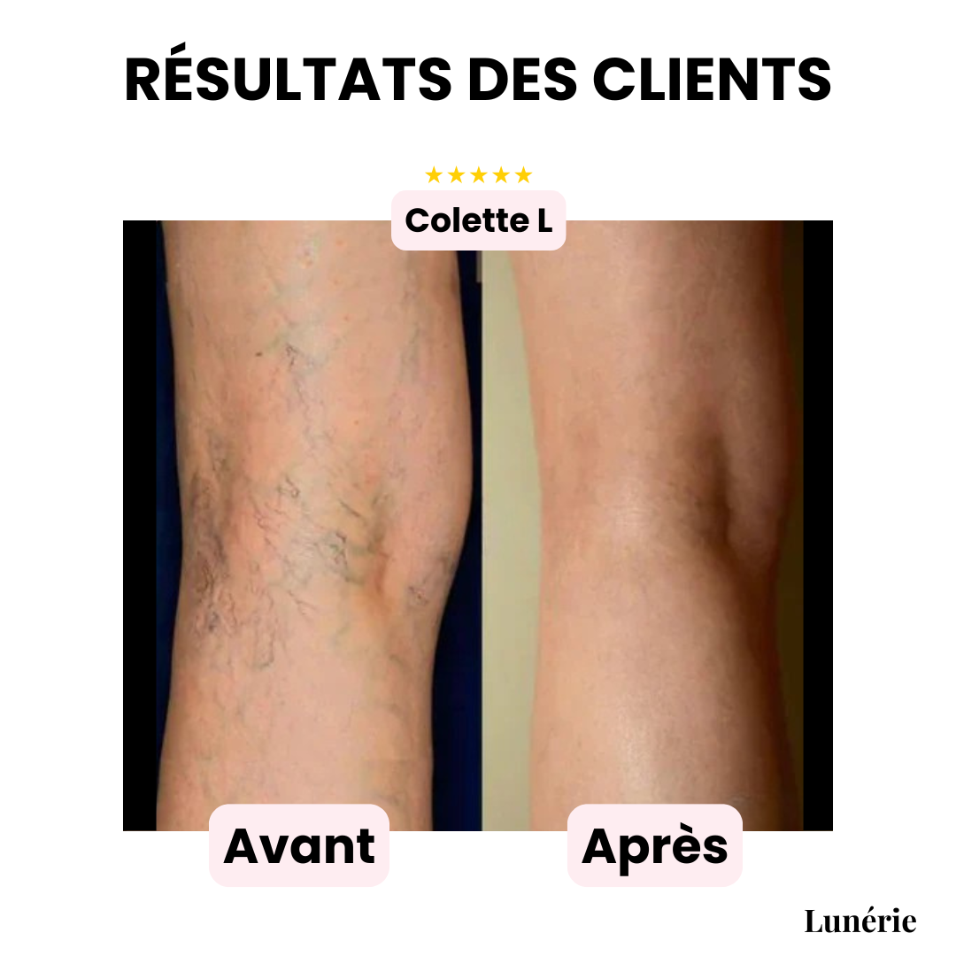 SilkVeil™ — Reveal Radiant, Flawless Skin That Lasts for Days