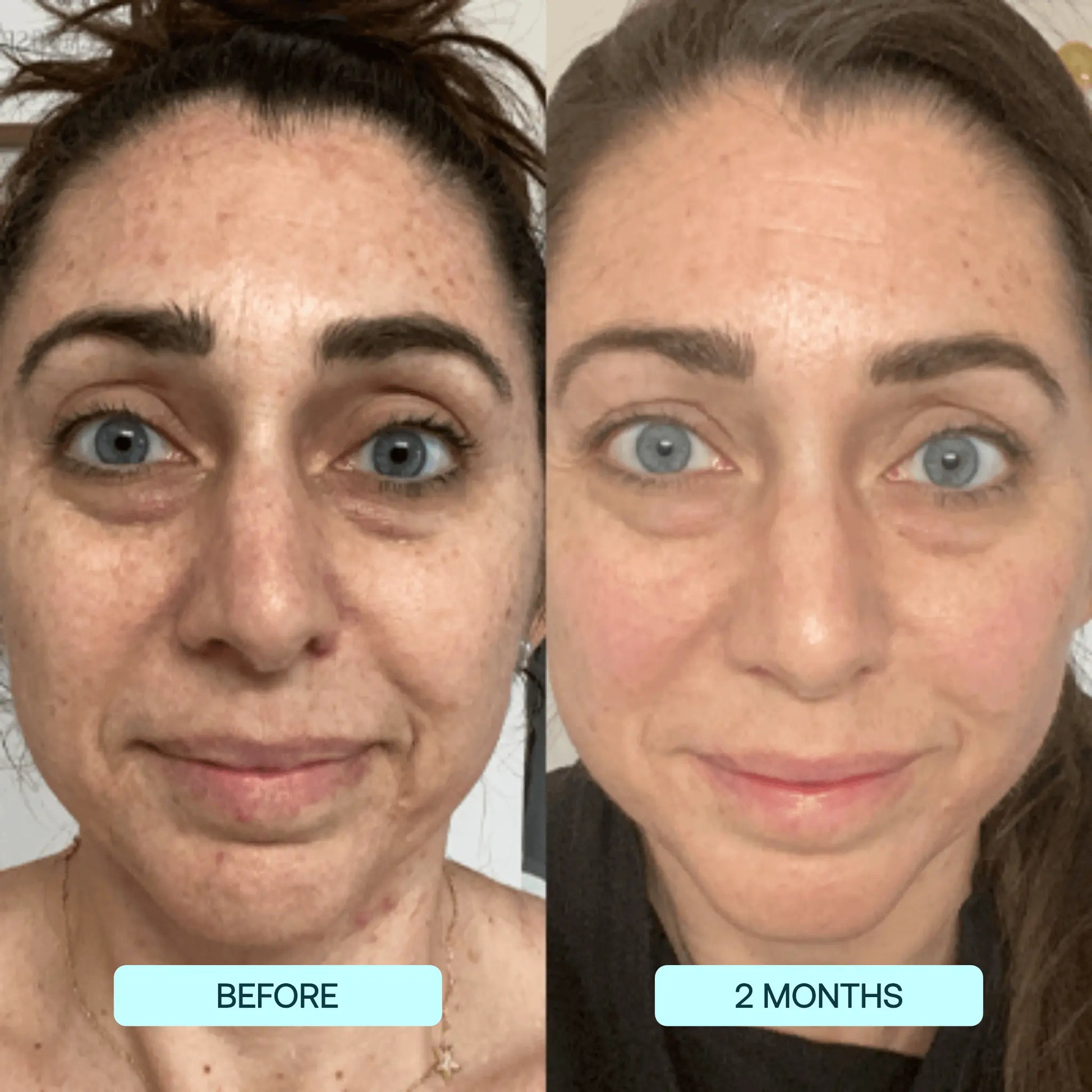 DermaSculpt™ Collagen Infusion — Reveal Firmer, Radiant Skin That Defies Time
