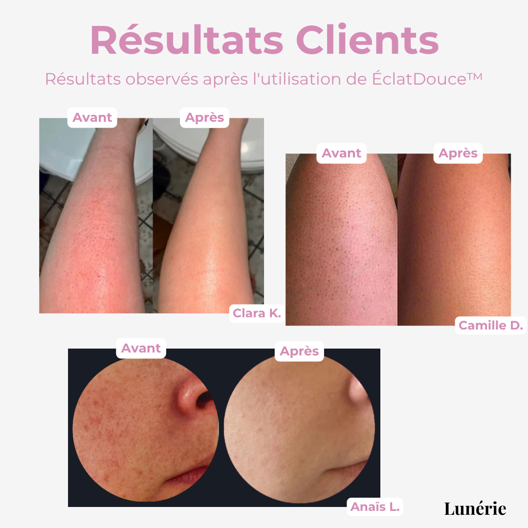 LumaPure™ — Unlock the Secret to Silky, Radiant Skin You Can’t Help But Show Off