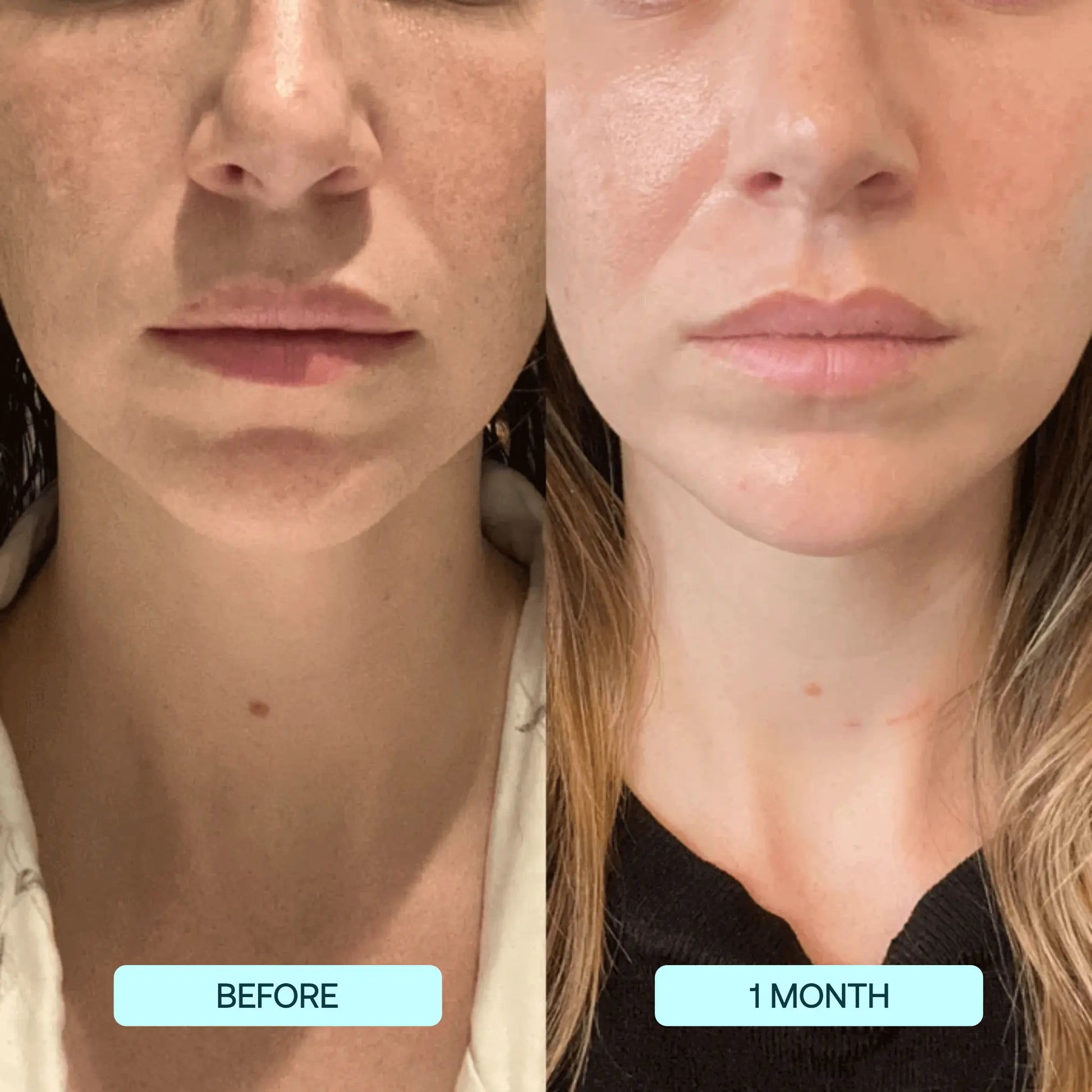 DermaSculpt™ Collagen Infusion — Reveal Firmer, Radiant Skin That Defies Time