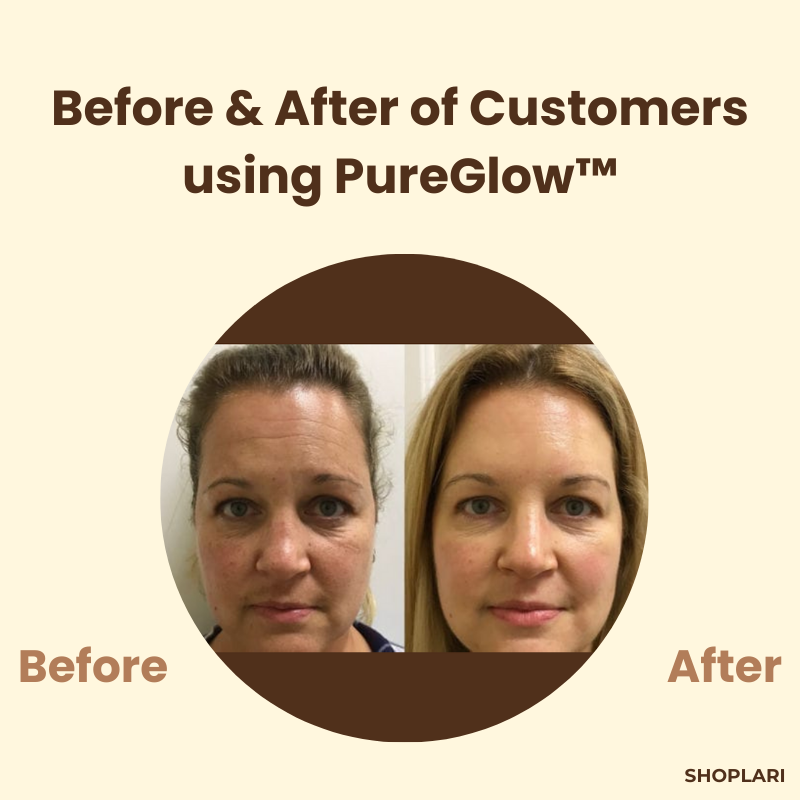 LumaBloom™ — Reveal Radiant, Spot-Free Skin That Turns Heads Instantly