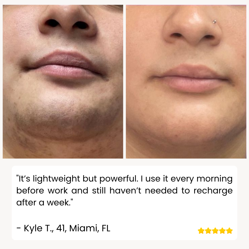 RamoxoPro™ — Effortless Precision Shaving That Leaves Your Skin Silky-Smooth and Irritation-Free